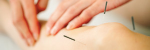 Acupuncture Port Moody
